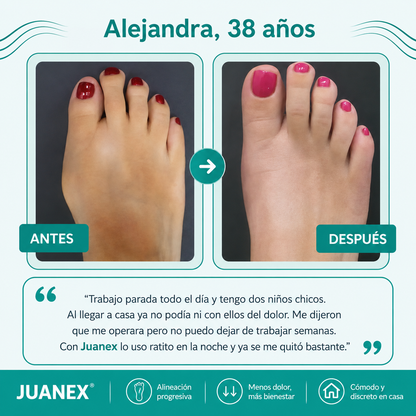 Juanex® | Corrector de Juanetes | ¡PRECIO ESPECIAL 50% OFF!