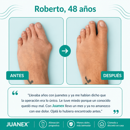 Juanex® | Corrector de Juanetes | ¡PRECIO ESPECIAL 50% OFF!