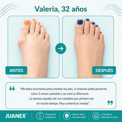 Juanex® | Corrector de Juanetes | ¡PRECIO ESPECIAL 50% OFF!