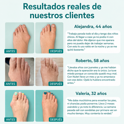 Juanex® | Corrector de Juanetes | ¡PRECIO ESPECIAL 50% OFF!